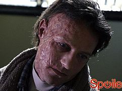 Nastoletni wilkołak: 1x04 Magic Bullet - zdjęcia promocyjne