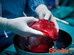 Lekarze: 2x02 I żyli długo i szczęśliwe...? - zdjęcia z planu