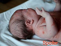 Na sygnale odc. 62 - zdjęcia promocyjne